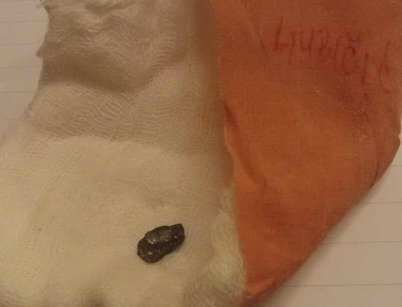 Mirko Ljubicic - Geler iz pluca